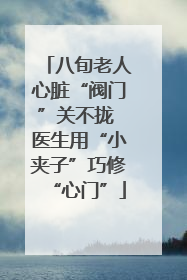 八旬老人心脏“阀门”关不拢 医生用“小夹子”巧修“心门”